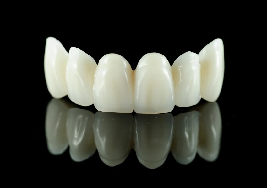 Coronas de zirconio