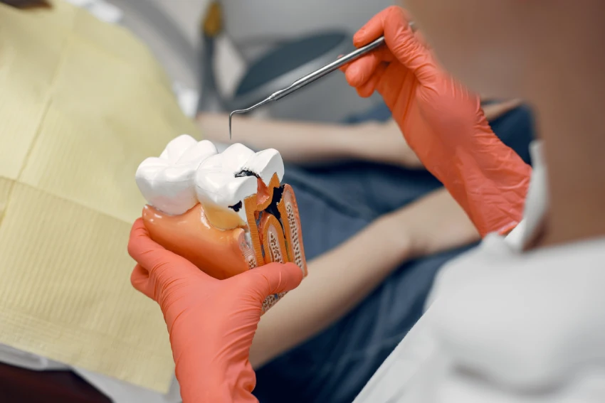 Tratamiento de endodoncia
